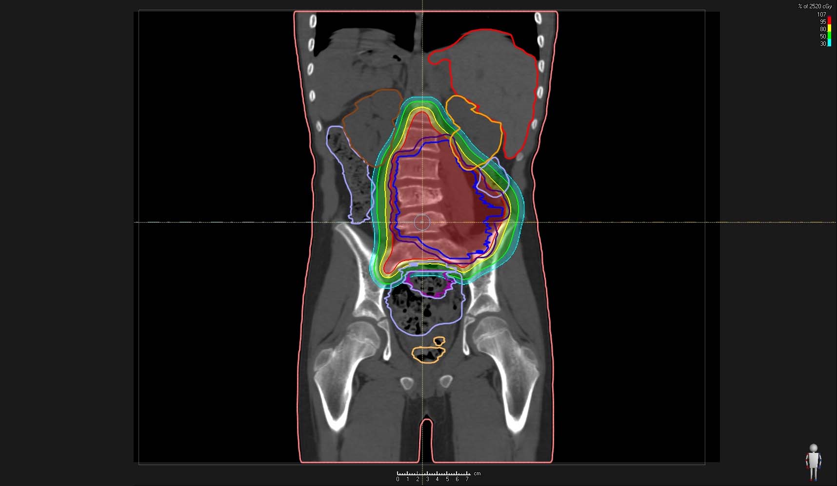 Sarcoma - Titelbild