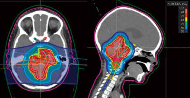 Rolle der modernen Strahlen- und Protonentherapie für Tumoren des Kindes- und Jugendalters – Teil 1 – „radiologie technologie“ 1/2020 - Titelbild