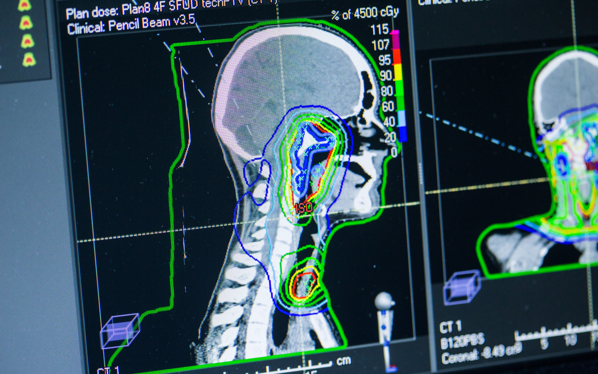 Proton Therapy - Titelbild