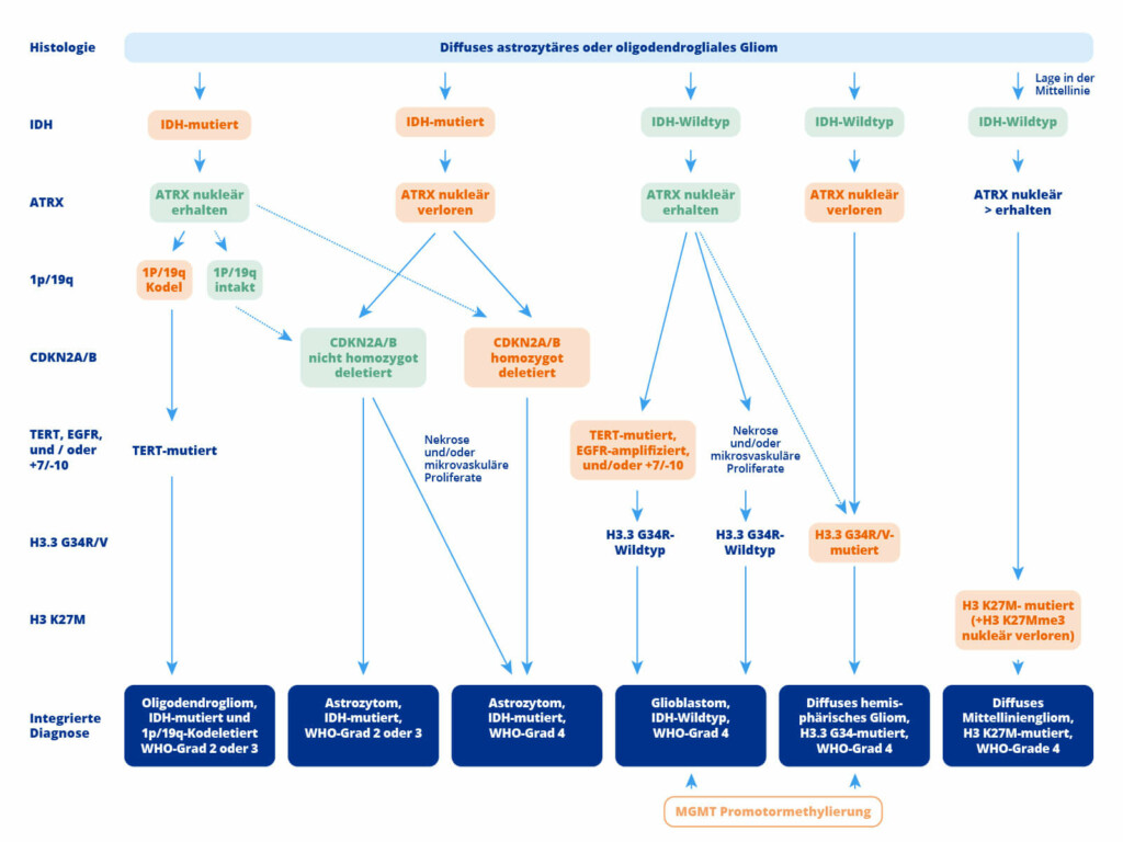 Einteilung von Gliomen nach AWMF Leitlinie.
